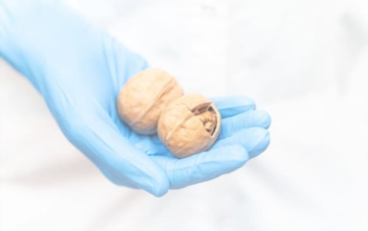 Tumor testicular